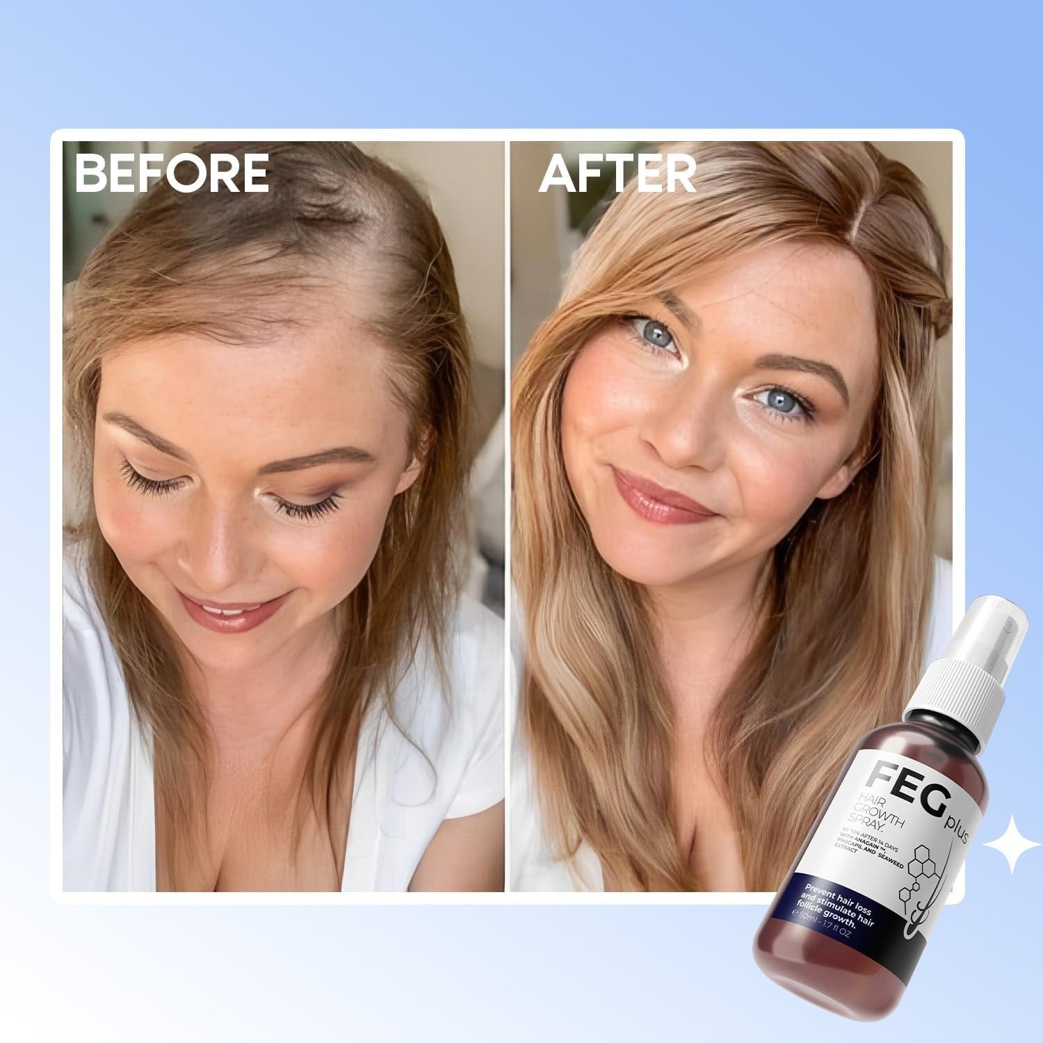 FEGPlus Beard & Hair Growth Serum